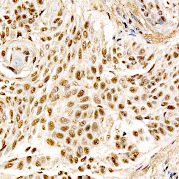 MDM2 Monoclonal Antibody