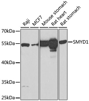 SMYD1 Polyclonal Antibody
