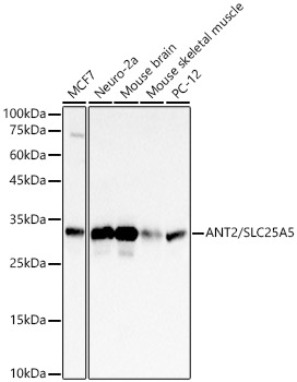 ANT2/SLC25A5 Monoclonal Antibody [9S4V9]