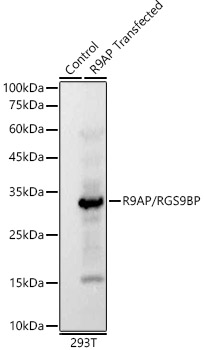 R9AP/RGS9BP Monoclonal Antibody [10U1U1]