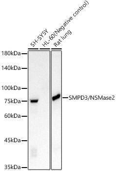 SMPD3/NSMase2 Monoclonal Antibody [7A4L3]