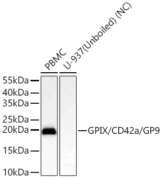 GPIX/CD42a/GP9 Monoclonal Antibody [3Z9Q9]