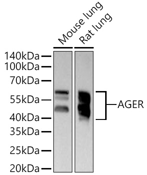 AGER Monoclonal Antibody [5M7T7]