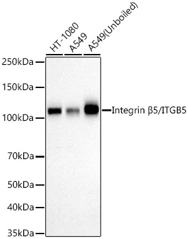 Integrin B5/ITGB5 Monoclonal Antibody [8D2B1]