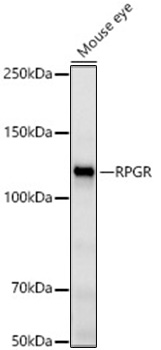 RPGR Monoclonal Antibody [2I7R3]