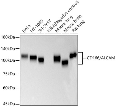 CD166/ALCAM Monoclonal Antibody [5H9C8]