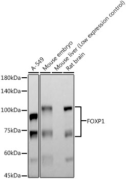 FOXP1 Monoclonal Antibody [10R3J6]