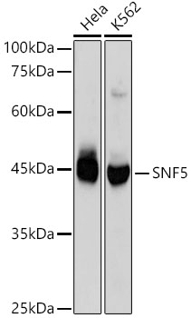SMARCB1/SNF5 Monoclonal Antibody [6X6T8]