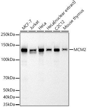 MCM2 Monoclonal Antibody [8E8O10]