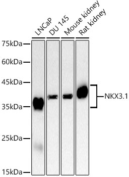 NKX3.1 Monoclonal Antibody [6T0Z1]