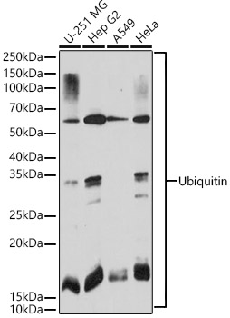 Ubiquitin Monoclonal Antibody [3K6J3]