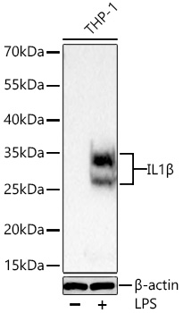 IL1B Monoclonal Antibody [6X7I2]