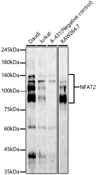 NFAT2 Monoclonal Antibody [5D4K1]