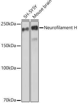Neurofilament H Monoclonal Antibody [8D2S2]