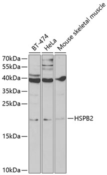 HSPB2 Polyclonal Antibody