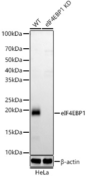 eIF4EBP1 Monoclonal Antibody [4T7O9]