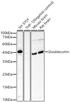 Doublecortin Monoclonal Antibody [5F9B2]