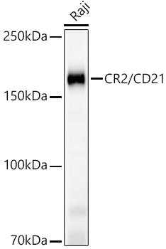 CR2/CD21 Monoclonal Antibody [9F8A1]