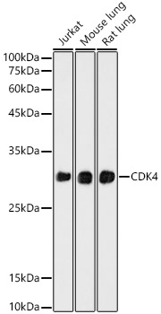 CDK4 Monoclonal Antibody [3G7Q7]