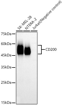 CD200 Monoclonal Antibody [4B0W5]