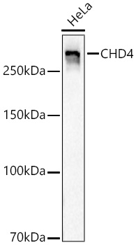 CHD4 Monoclonal Antibody [0M3R5]