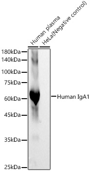Human IgA1 Monoclonal Antibody [6N7H1]