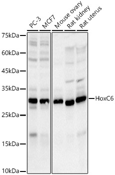 HoxC6 Monoclonal Antibody [8H7N8]