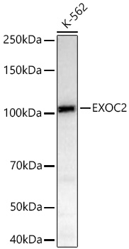 EXOC2 Monoclonal Antibody [5S2X9]