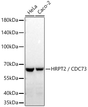HRPT2 / CDC73 Monoclonal Antibody [1B8Q1]
