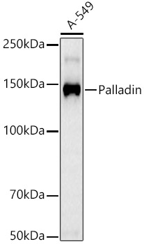 Palladin Monoclonal Antibody [3P2R2]