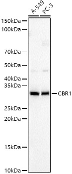 CBR1 Monoclonal Antibody [7O1Y3]