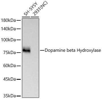 Dopamine beta Hydroxylase Monoclonal Antibody [1B10B7]