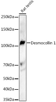 Desmocollin 1 Monoclonal Antibody [3U3Y2]