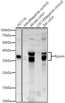 Epcam Polyclonal Antibody