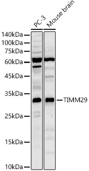 TIMM29 Polyclonal Antibody