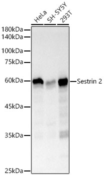 Sestrin 2 Monoclonal Antibody [8I1W4]