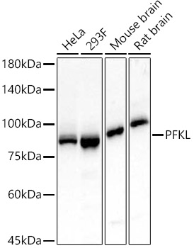 PFKL Monoclonal Antibody [2F0Z3]