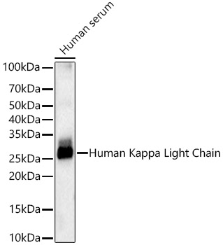 Human Kappa Light Chain Monoclonal Antibody [7X9M3]