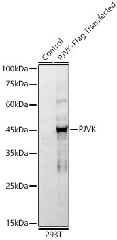 PJVK Monoclonal Antibody [10R1X6]