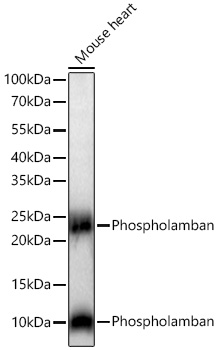 Phospholamban Monoclonal Antibody [3A8Q9]