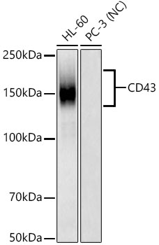 CD43 Monoclonal Antibody [9D10L2]