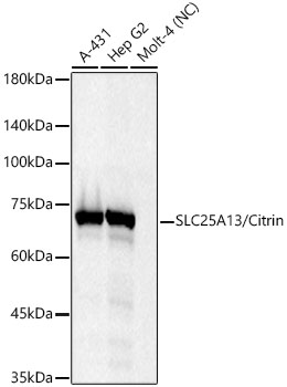 SLC25A13/Citrin Monoclonal Antibody [9L4I7]