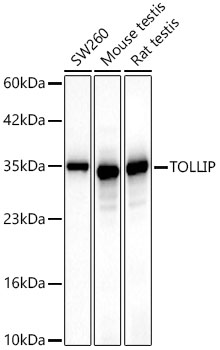 TOLLIP Monoclonal Antibody [6L9Z2]