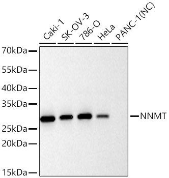 NNMT Monoclonal Antibody [7S1G2]