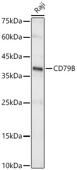 CD79B Monoclonal Antibody [7C5Q1]