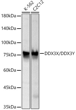 DDX3X/DDX3Y Monoclonal Antibody [1N2I8]
