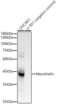 Mesothelin Monoclonal Antibody [5X7L7]