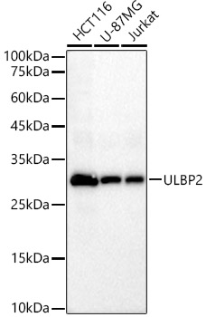 ULBP2 Monoclonal Antibody [7R4V6]