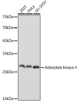 Adenylate kinase 4 Monoclonal Antibody [9T5P1]&nbsp;<img src="images/icon_newarrival.gif" alt="new" border="0">