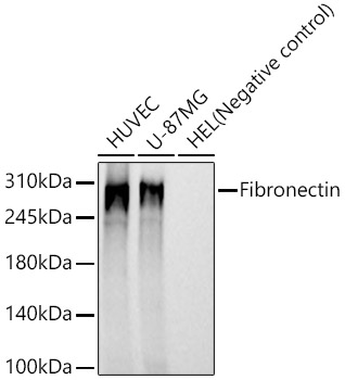 Fibronectin Monoclonal Antibody [8K9R3]